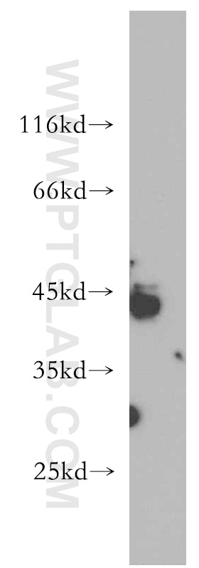 Western Blot (WB) analysis of Y79 cells using RNF150 Polyclonal antibody (21438-1-AP)