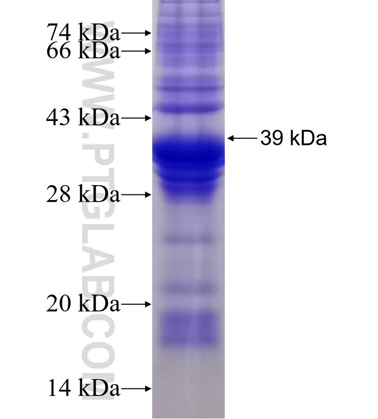 RNF150 fusion protein Ag16064 SDS-PAGE