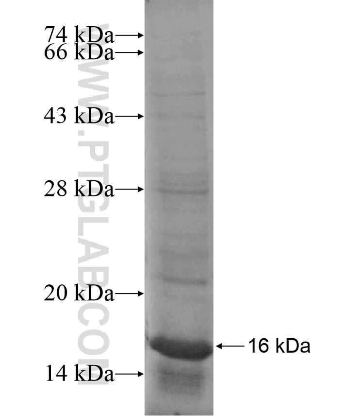 RNF150 fusion protein Ag16989 SDS-PAGE