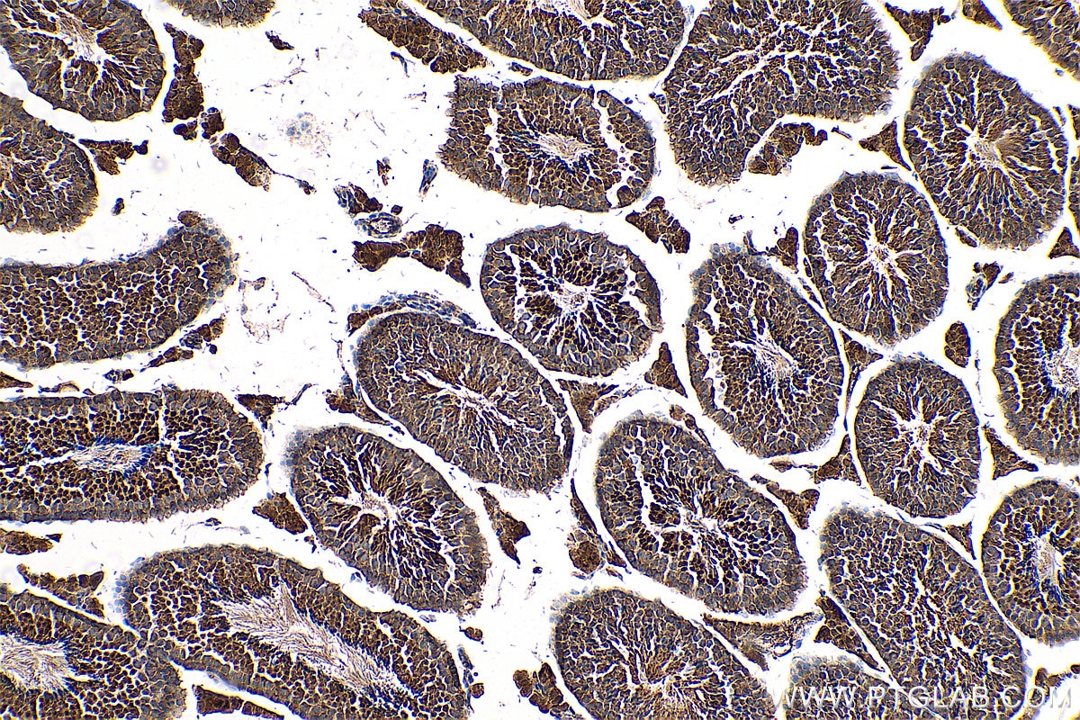 Immunohistochemistry (IHC) staining of mouse testis tissue using RNF151 Polyclonal antibody (24708-1-AP)