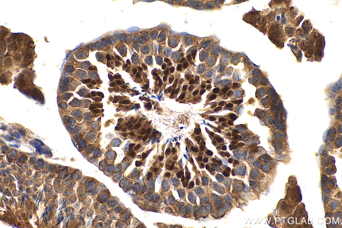 Immunohistochemistry (IHC) staining of mouse testis tissue using RNF151 Polyclonal antibody (24708-1-AP)