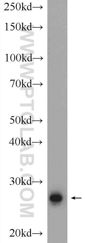 Western Blot (WB) analysis of rat testis tissue using RNF151 Polyclonal antibody (24708-1-AP)