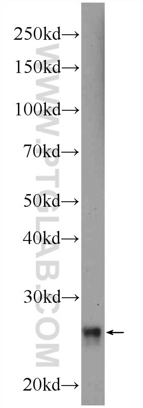 Western Blot (WB) analysis of human testis tissue using RNF151 Polyclonal antibody (24708-1-AP)