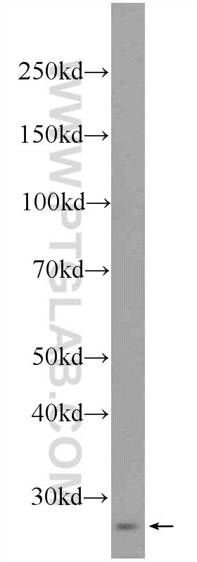 Western Blot (WB) analysis of mouse testis tissue using RNF151 Polyclonal antibody (24708-1-AP)