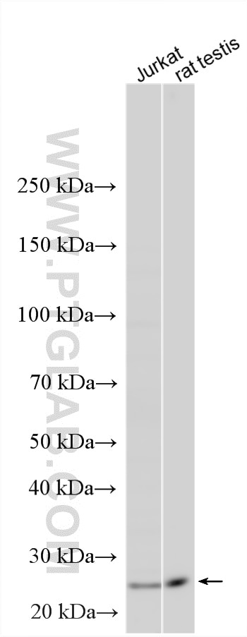 WB analysis using 24708-1-AP Western Blot (WB) analysis of various lysates using RNF151 Polyclonal antibody (24708-1-AP)