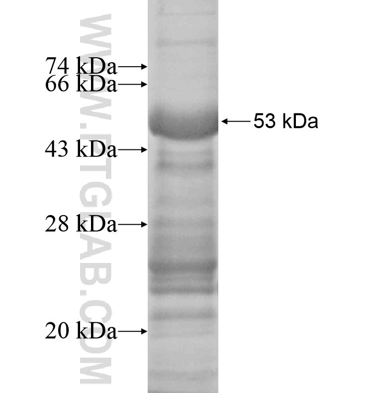 RNF151 fusion protein Ag16606 SDS-PAGE
