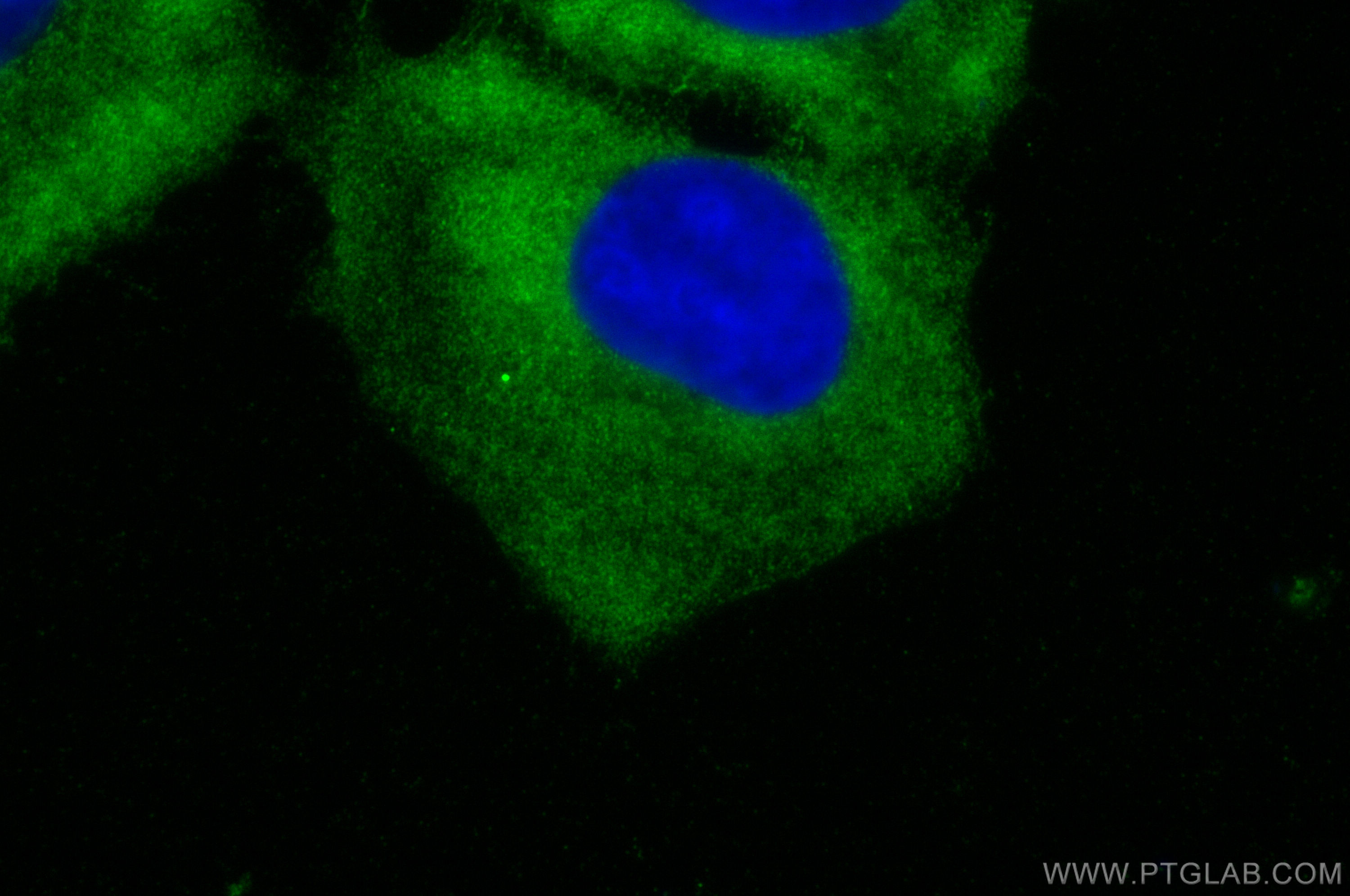 Immunofluorescence (IF) / fluorescent staining of U2OS cells using RNF160 Polyclonal antibody (28452-1-AP)