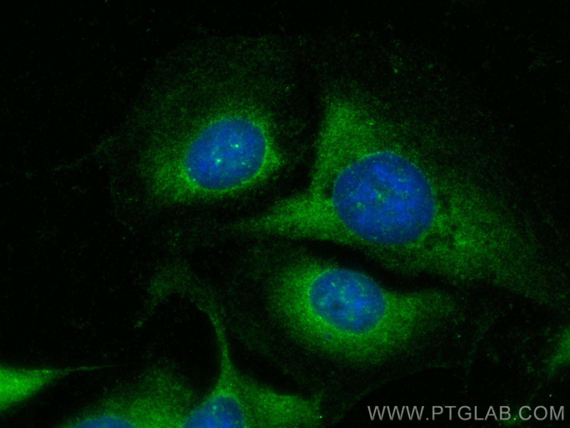 Immunofluorescence (IF) / fluorescent staining of U2OS cells using RNF160 Polyclonal antibody (28452-1-AP)