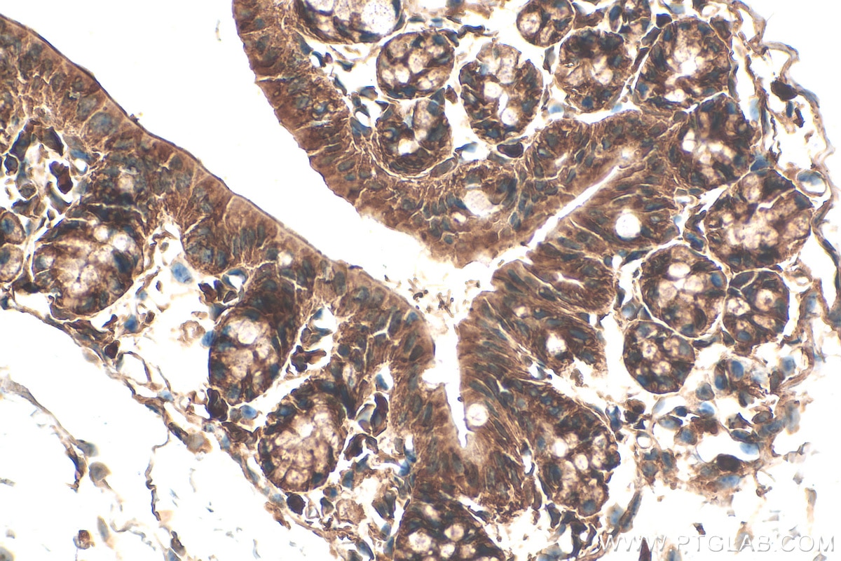 Immunohistochemistry (IHC) staining of mouse colon tissue using RNF160 Polyclonal antibody (28452-1-AP)