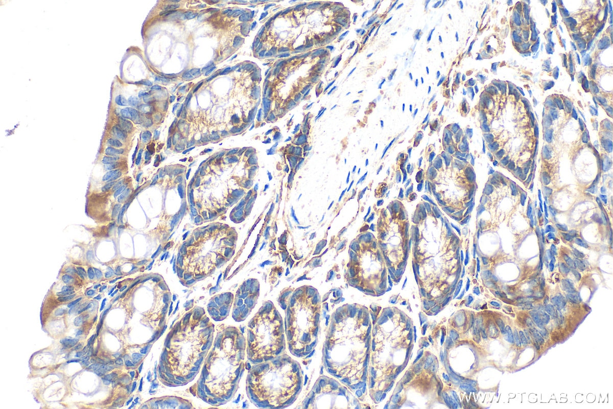 Immunohistochemistry (IHC) staining of mouse colon tissue using RNF160 Polyclonal antibody (28452-1-AP)