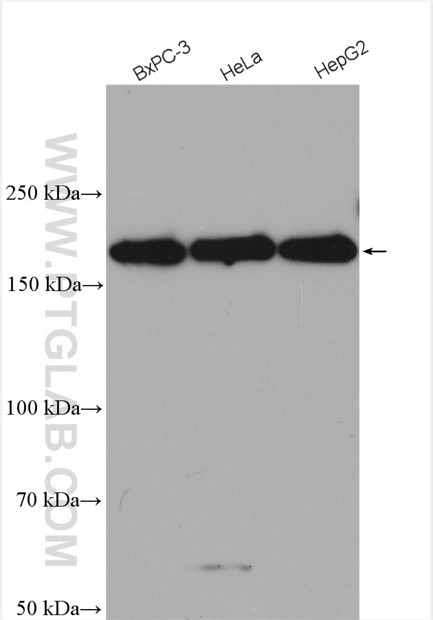 Western Blot (WB) analysis of various lysates using RNF160 Polyclonal antibody (28452-1-AP)