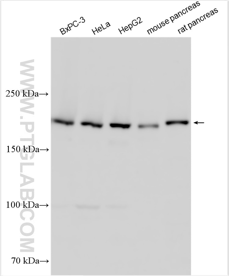 Western Blot (WB) analysis of various lysates using RNF160 Polyclonal antibody (28452-1-AP)