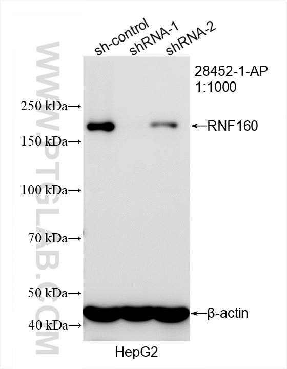 Western Blot (WB) analysis of HepG2 cells using RNF160 Polyclonal antibody (28452-1-AP)