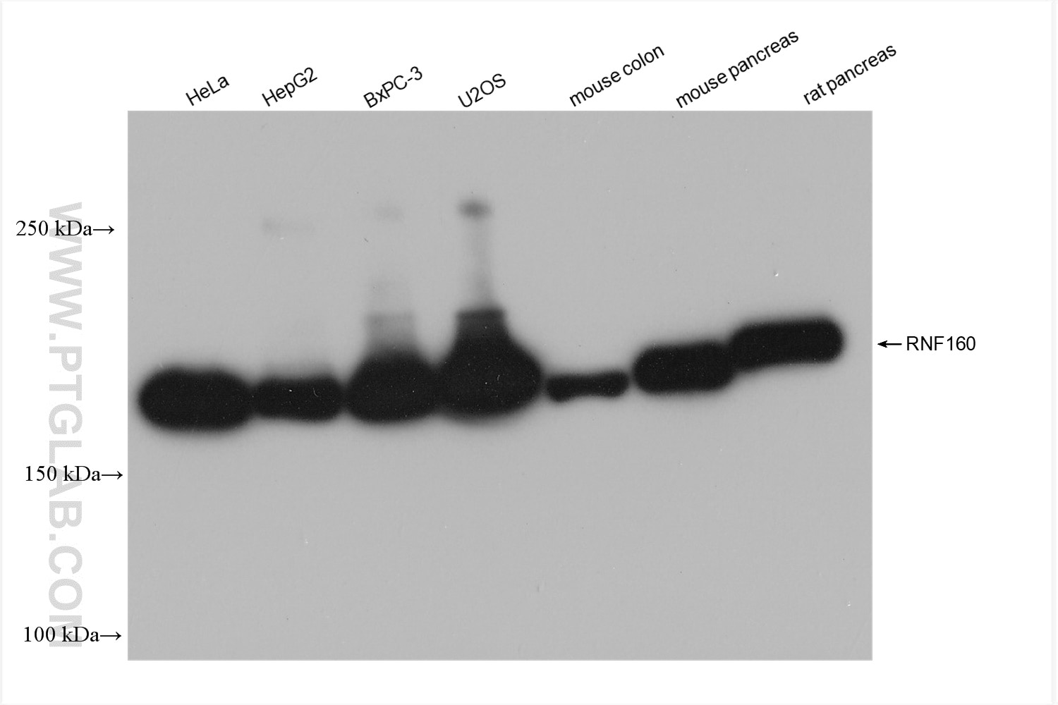 Western Blot (WB) analysis of various lysates using RNF160 Recombinant antibody (82926-1-RR)