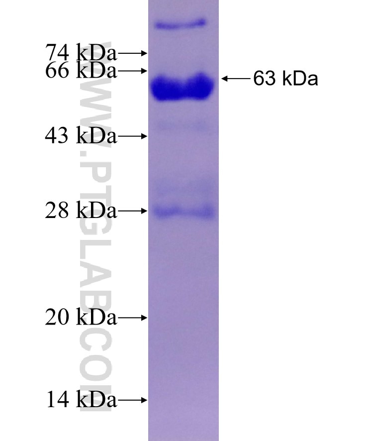 RNF160 fusion protein Ag29467 SDS-PAGE