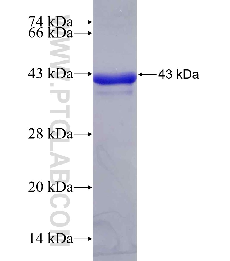 RNF160 fusion protein Ag29471 SDS-PAGE
