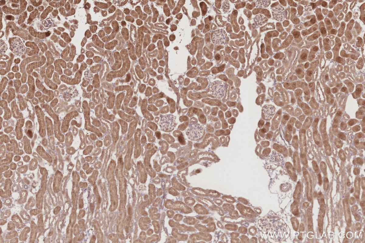 Immunohistochemistry (IHC) staining of mouse kidney tissue using RNF167 Polyclonal antibody (24618-1-AP)