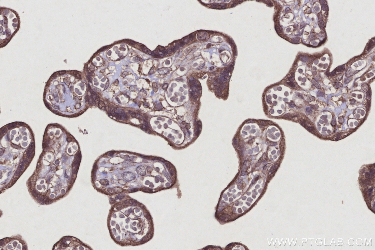 Immunohistochemistry (IHC) staining of human placenta tissue using RNF167 Polyclonal antibody (24618-1-AP)