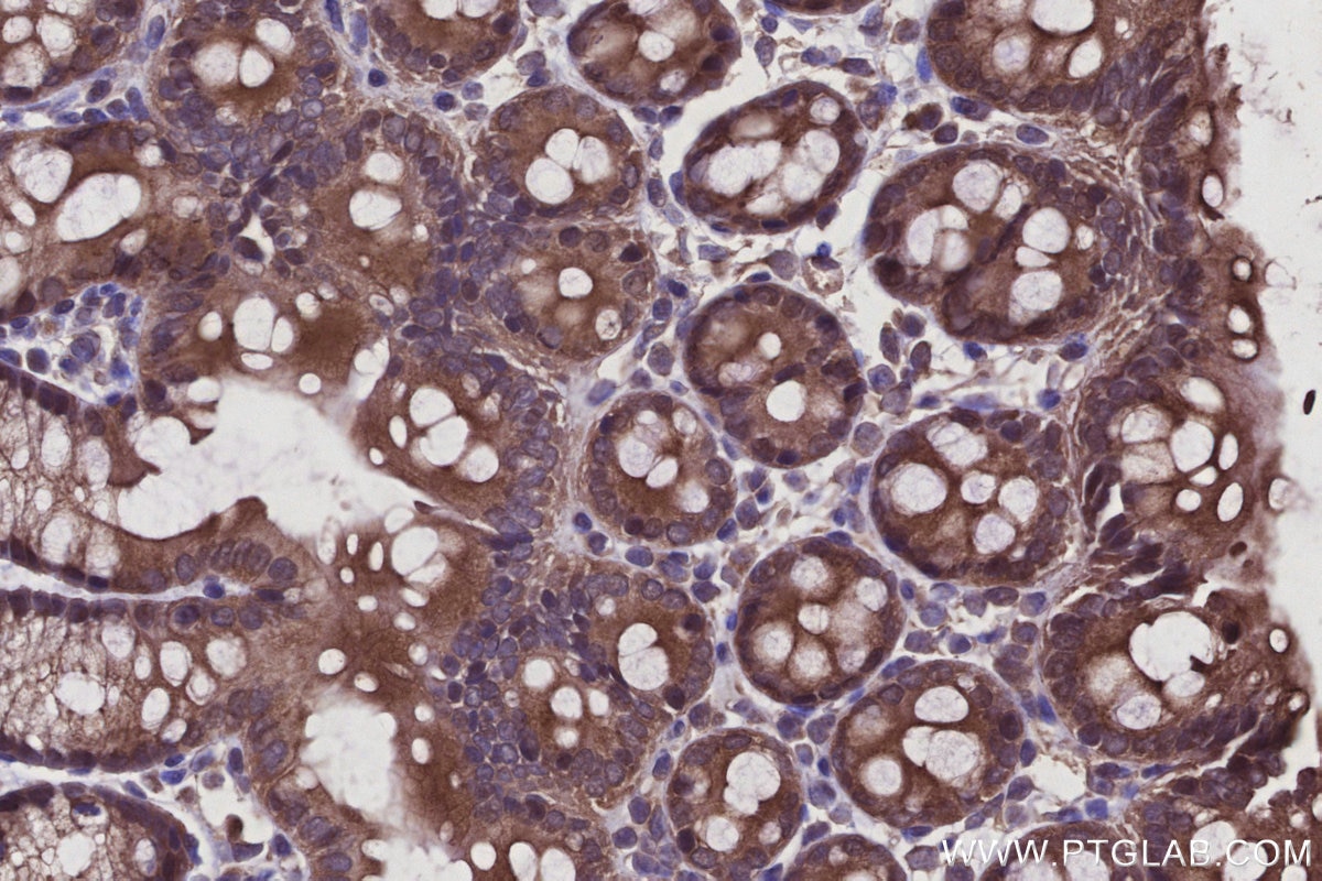 Immunohistochemistry (IHC) staining of mouse colon tissue using RNF167 Polyclonal antibody (24618-1-AP)