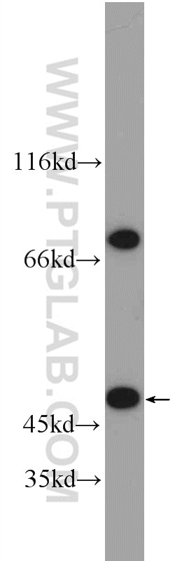 Western Blot (WB) analysis of mouse testis tissue using RNF167 Polyclonal antibody (24618-1-AP)