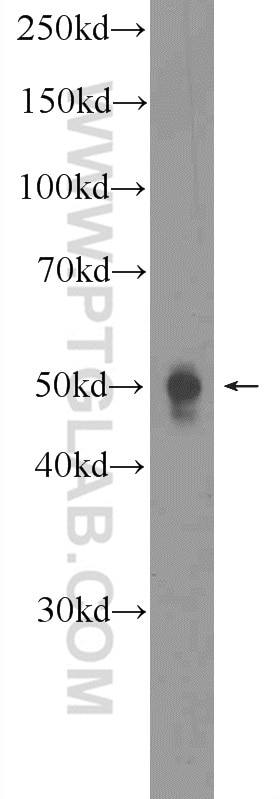 Western Blot (WB) analysis of mouse brain tissue using RNF167 Polyclonal antibody (24618-1-AP)