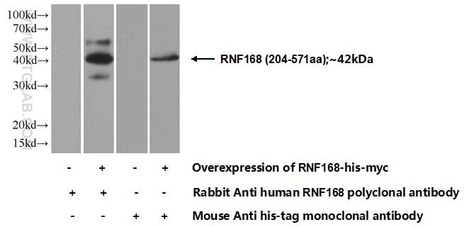 Western Blot (WB) analysis of Transfected HEK-293 cells using RNF168 Polyclonal antibody (21393-1-AP)