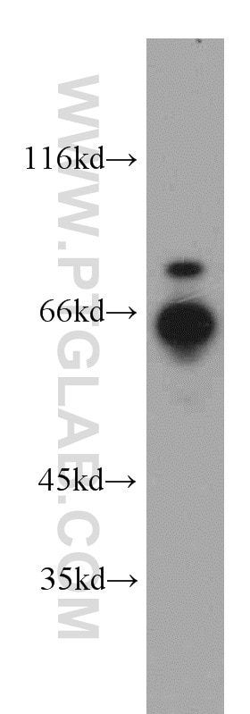 Western Blot (WB) analysis of HepG2 cells using RNF168 Polyclonal antibody (21393-1-AP)