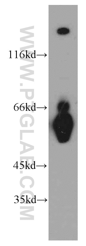 Western Blot (WB) analysis of human brain tissue using RNF168 Polyclonal antibody (21393-1-AP)