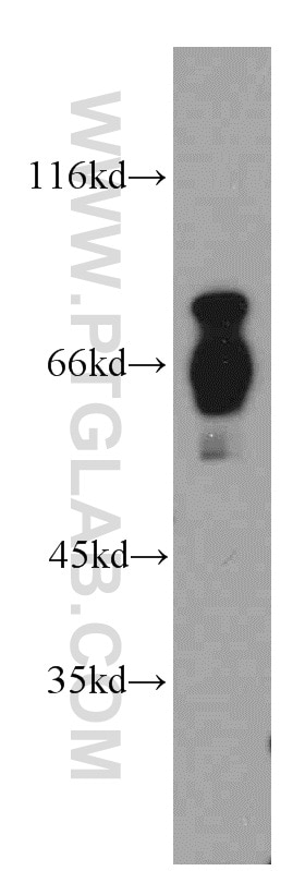 Western Blot (WB) analysis of HeLa cells using RNF168 Polyclonal antibody (21393-1-AP)