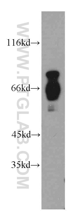 WB analysis of HeLa using 21393-1-AP