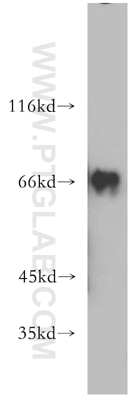 Western Blot (WB) analysis of Jurkat cells using RNF168 Polyclonal antibody (21393-1-AP)