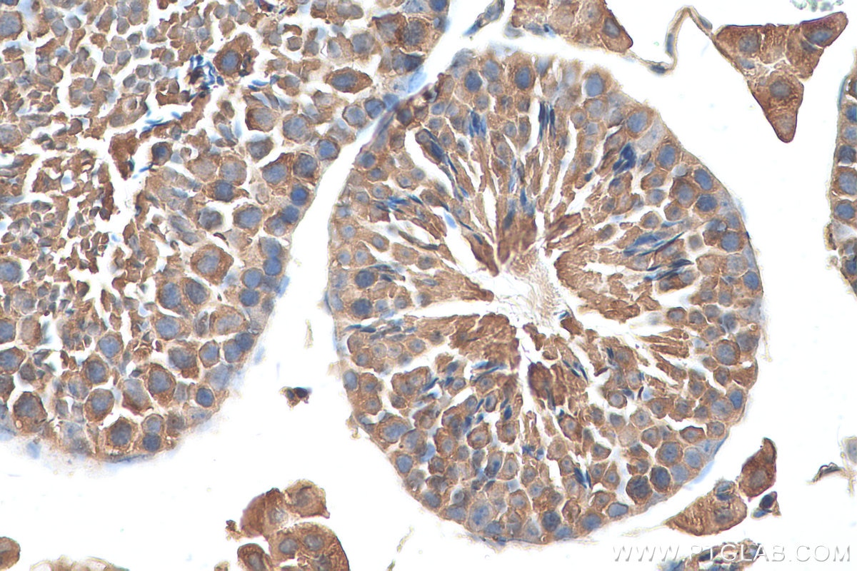 Immunohistochemistry (IHC) staining of mouse testis tissue using RNF17 Polyclonal antibody (24302-1-AP)