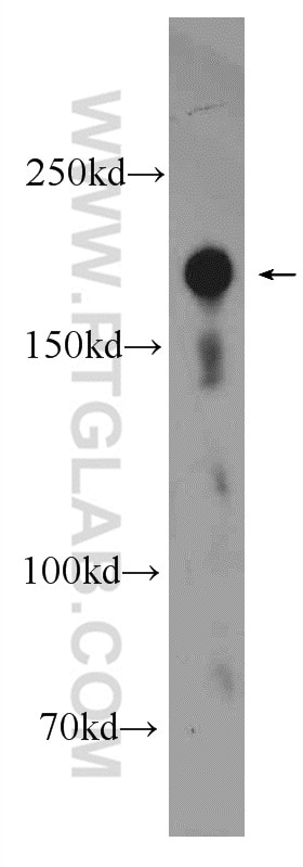 Western Blot (WB) analysis of human testis tissue using RNF17 Polyclonal antibody (24302-1-AP)