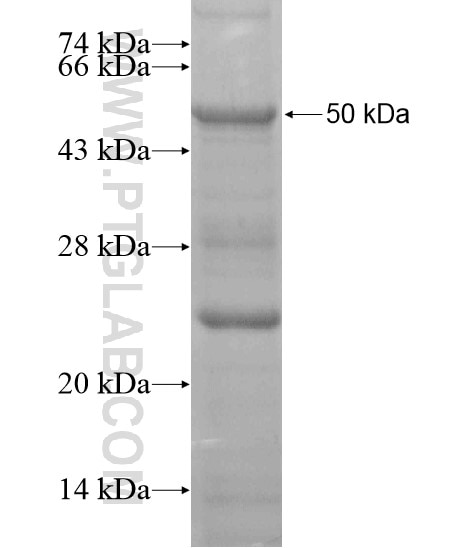 RNF17 fusion protein Ag20144 SDS-PAGE