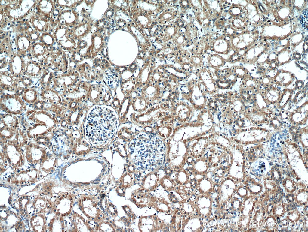 Immunohistochemistry (IHC) staining of human kidney tissue using RNF170 Polyclonal antibody (21024-1-AP)
