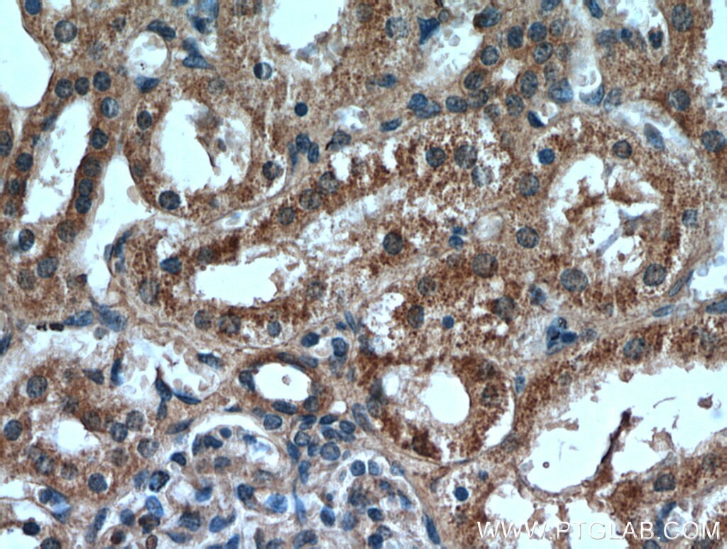 Immunohistochemistry (IHC) staining of human kidney tissue using RNF170 Polyclonal antibody (21024-1-AP)