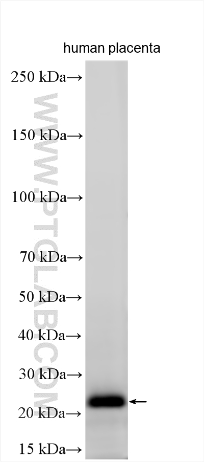 WB analysis using 21024-1-AP Western Blot (WB) analysis of various lysates using RNF170 Polyclonal antibody (21024-1-AP)