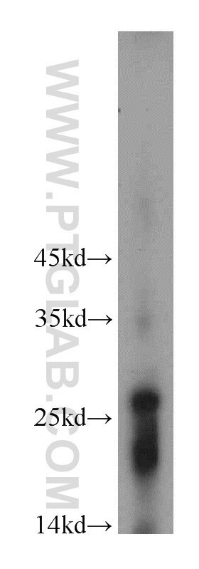 Western Blot (WB) analysis of human placenta tissue using RNF170 Polyclonal antibody (21024-1-AP)