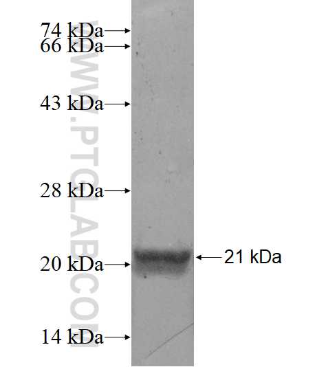 RNF170 fusion protein Ag15495 SDS-PAGE