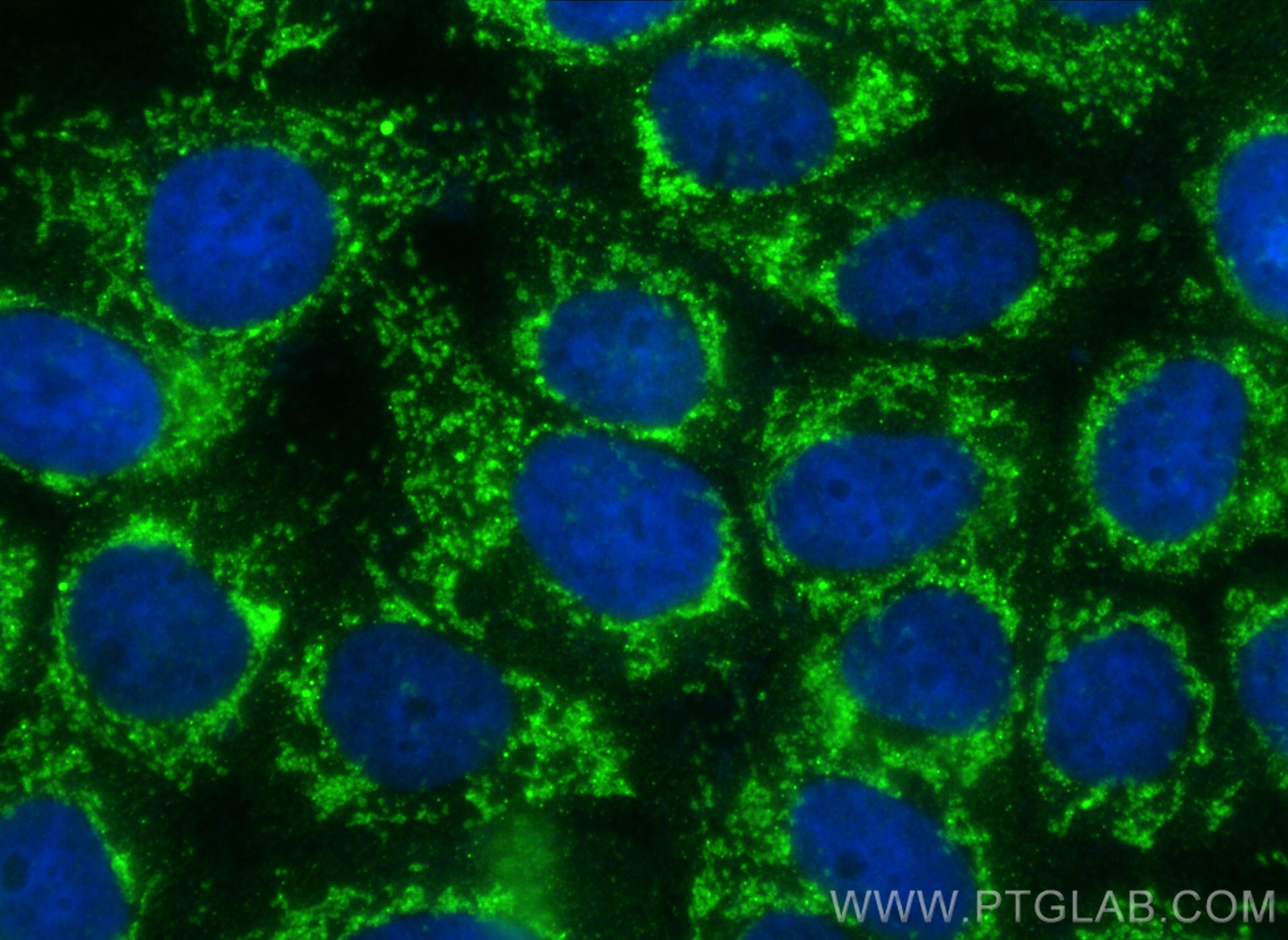 Immunofluorescence (IF) / fluorescent staining of A431 cells using RNF180 Polyclonal antibody (30941-1-AP)