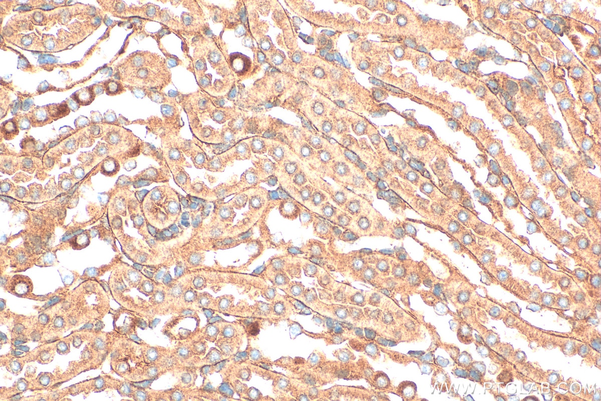 Immunohistochemistry (IHC) staining of mouse kidney tissue using RNF180 Polyclonal antibody (30941-1-AP)