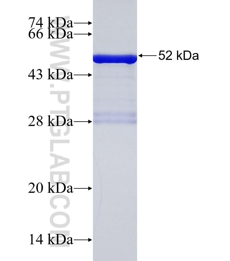 RNF180 fusion protein Ag34138 SDS-PAGE