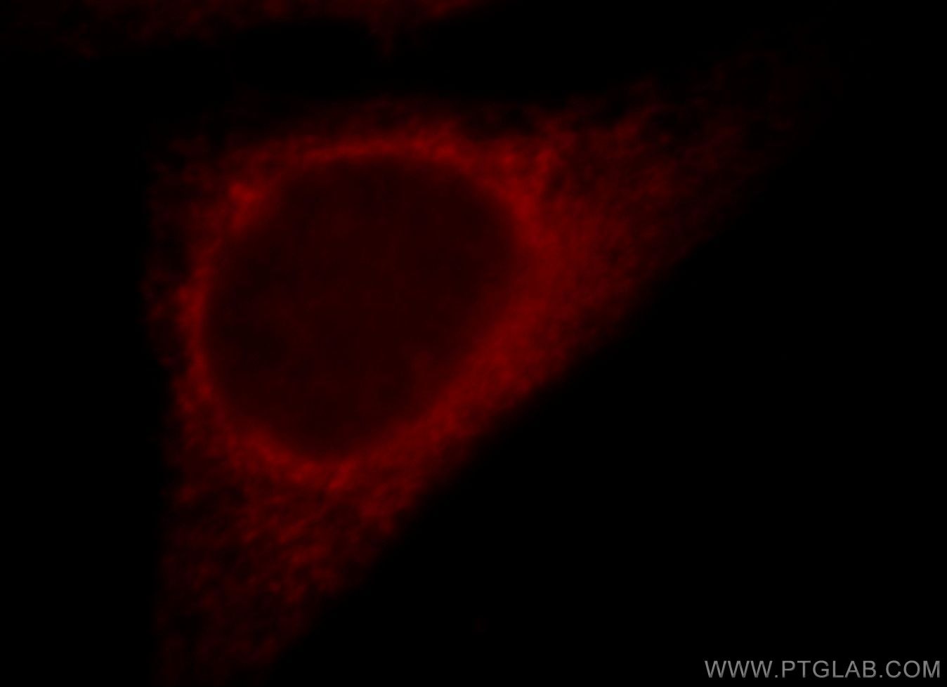 Immunofluorescence (IF) / fluorescent staining of HepG2 cells using RNF181 Polyclonal antibody (20408-1-AP)