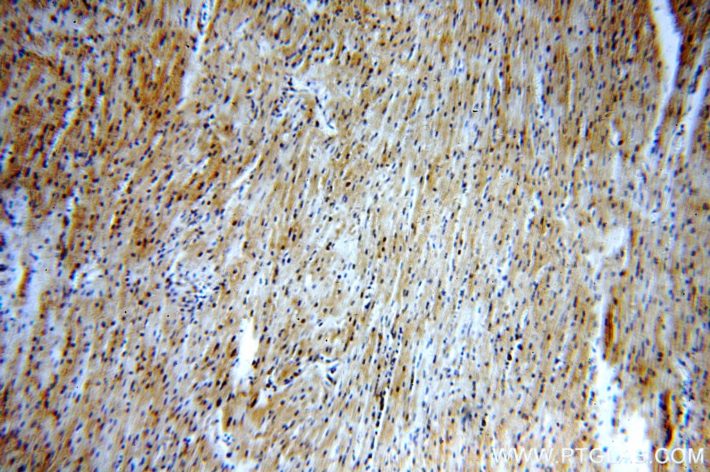 Immunohistochemistry (IHC) staining of human heart tissue using RNF181 Polyclonal antibody (20408-1-AP)