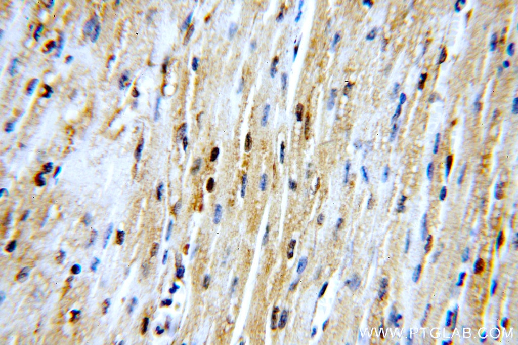 Immunohistochemistry (IHC) staining of human heart tissue using RNF181 Polyclonal antibody (20408-1-AP)