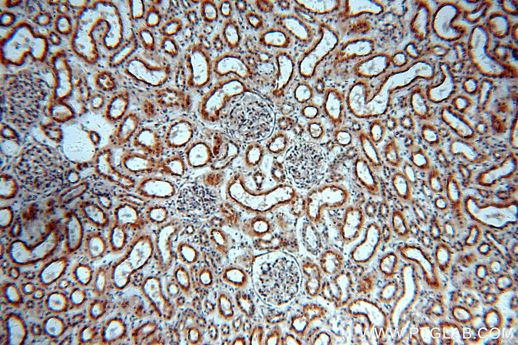IHC staining of human kidney using 20408-1-AP