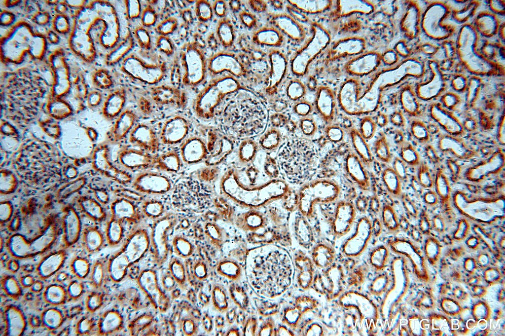 Immunohistochemistry (IHC) staining of human kidney tissue using RNF181 Polyclonal antibody (20408-1-AP)