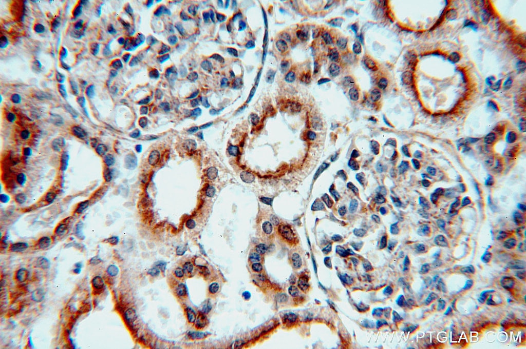 Immunohistochemistry (IHC) staining of human kidney tissue using RNF181 Polyclonal antibody (20408-1-AP)