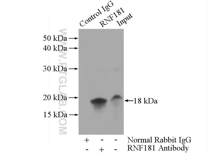 Immunoprecipitation (IP) experiment of Jurkat cells using RNF181 Polyclonal antibody (20408-1-AP)