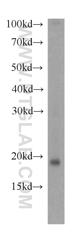 Western Blot (WB) analysis of L02 cells using RNF181 Polyclonal antibody (20408-1-AP)